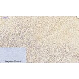 Immunohistochemistry - Anti-p38 MAPK Antibody (B7179) - Antibodies.com
