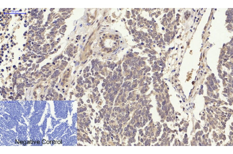 Immunohistochemistry - Anti-p38 MAPK Antibody (B7179) - Antibodies.com