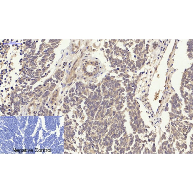 Immunohistochemistry - Anti-p38 MAPK Antibody (B7179) - Antibodies.com