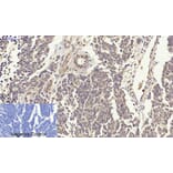 Immunohistochemistry - Anti-p38 MAPK Antibody (B7179) - Antibodies.com