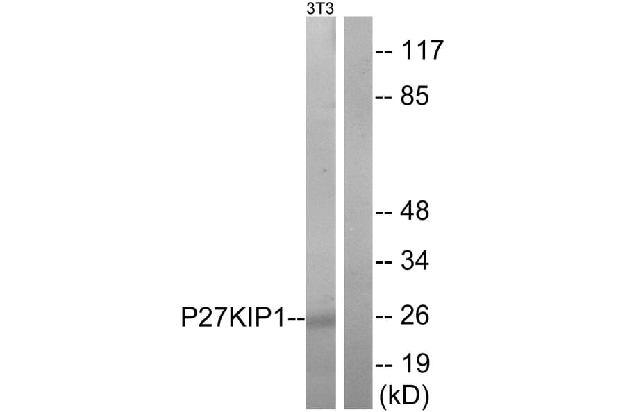 Western Blot - Anti-p27 Kip1 Antibody (B7177) - Antibodies.com