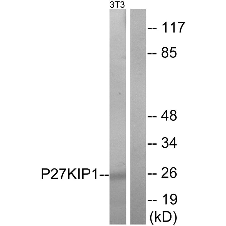 Western Blot - Anti-p27 Kip1 Antibody (B7177) - Antibodies.com