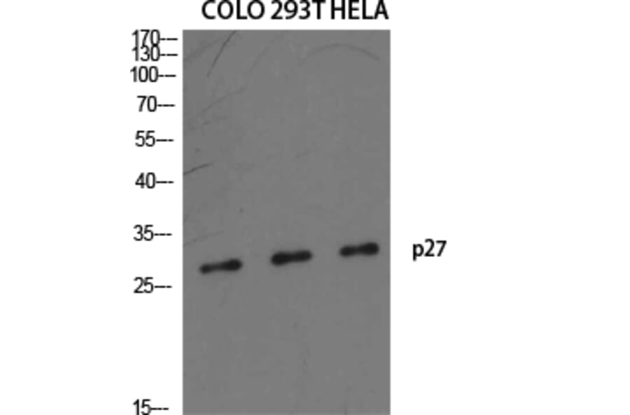 Western Blot - Anti-p27 Kip1 Antibody (B7177) - Antibodies.com