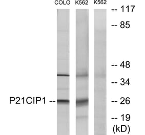Western Blot - Anti-p21 Cip1 Antibody (B7175) - Antibodies.com