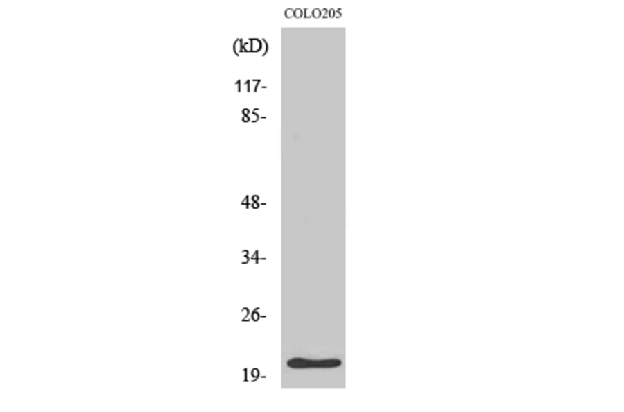 Western Blot - Anti-p21 Cip1 Antibody (B7175) - Antibodies.com