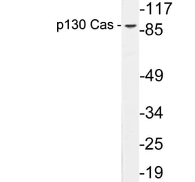 Western Blot - Anti-p130 Cas Antibody (R12-2285) - Antibodies.com
