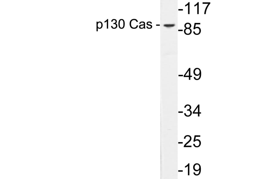 Western Blot - Anti-p130 Cas Antibody (R12-2285) - Antibodies.com