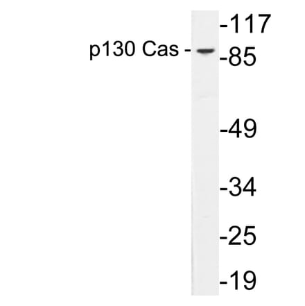 Western Blot - Anti-p130 Cas Antibody (R12-2285) - Antibodies.com