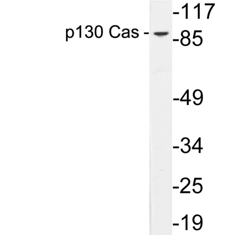 Western Blot - Anti-p130 Cas Antibody (R12-2285) - Antibodies.com