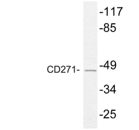 Western Blot - Anti-NGFR p75 Antibody (R12-2265) - Antibodies.com