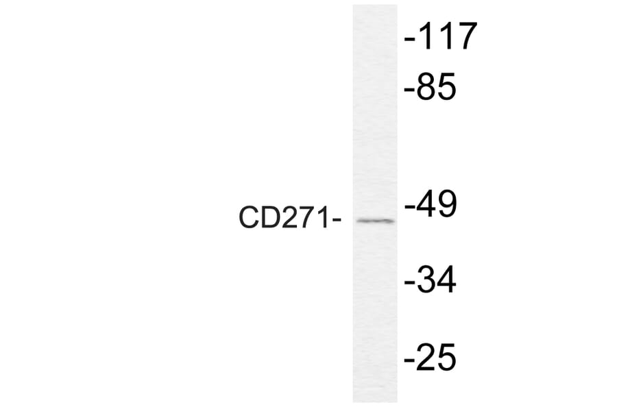 Western Blot - Anti-NGFR p75 Antibody (R12-2265) - Antibodies.com