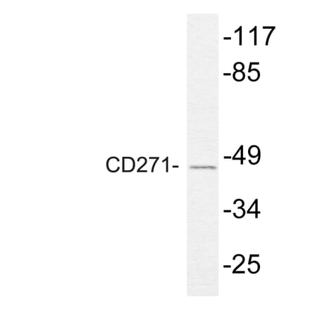 Western Blot - Anti-NGFR p75 Antibody (R12-2265) - Antibodies.com