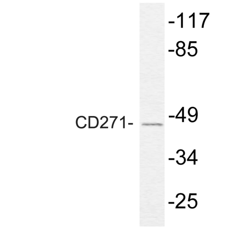 Western Blot - Anti-NGFR p75 Antibody (R12-2265) - Antibodies.com