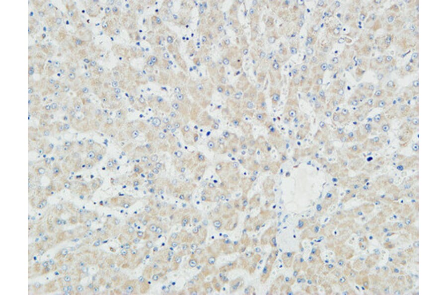 Immunohistochemistry - Anti-Myogenin Antibody (R12-2246) - Antibodies.com