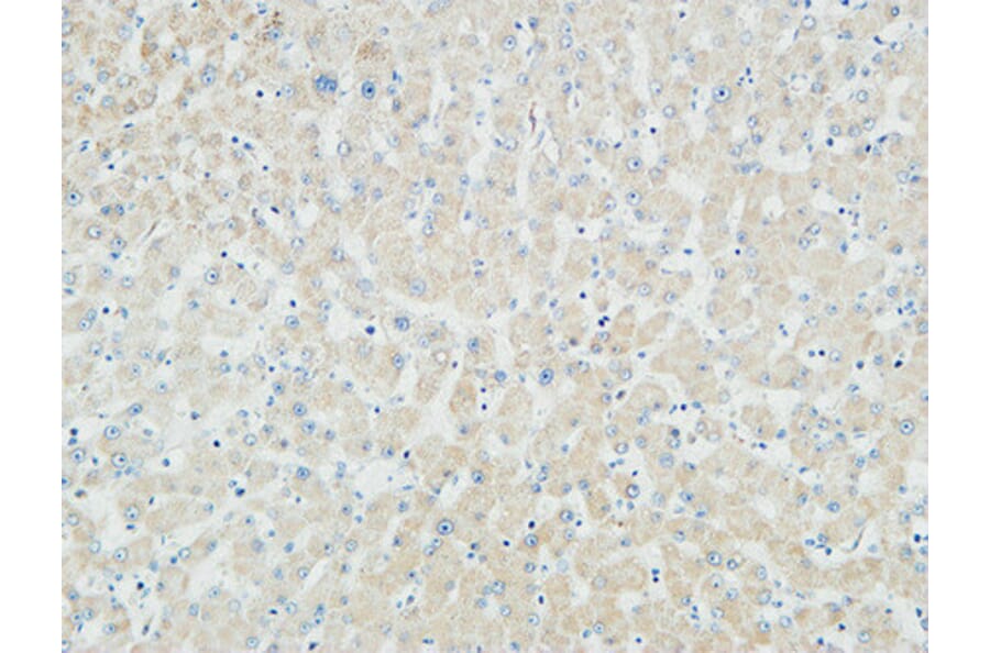 Immunohistochemistry - Anti-Myogenin Antibody (R12-2246) - Antibodies.com