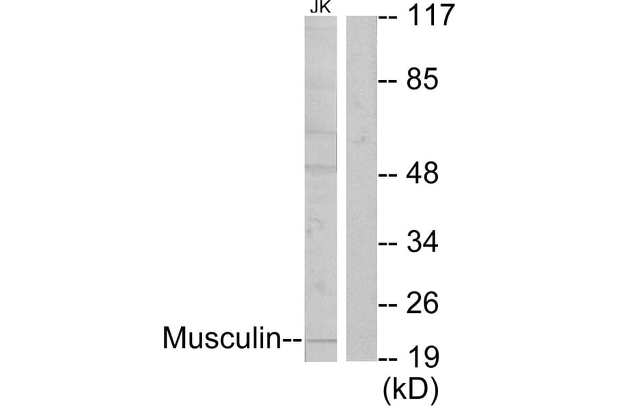 Western Blot - Anti-Musculin Antibody (C10147) - Antibodies.com