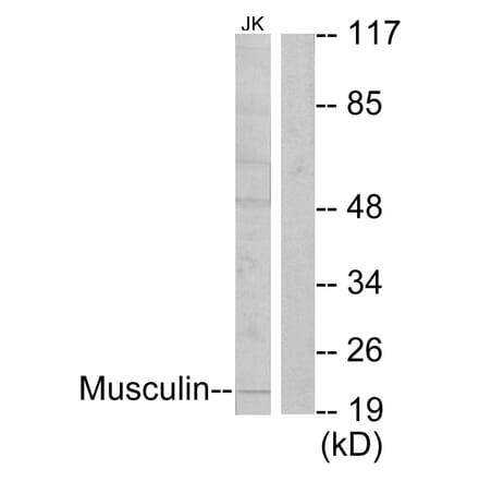 Western Blot - Anti-Musculin Antibody (C10147) - Antibodies.com