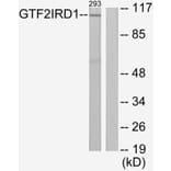 Western Blot - Anti-GTF2IRD1 Antibody (C11847) - Antibodies.com