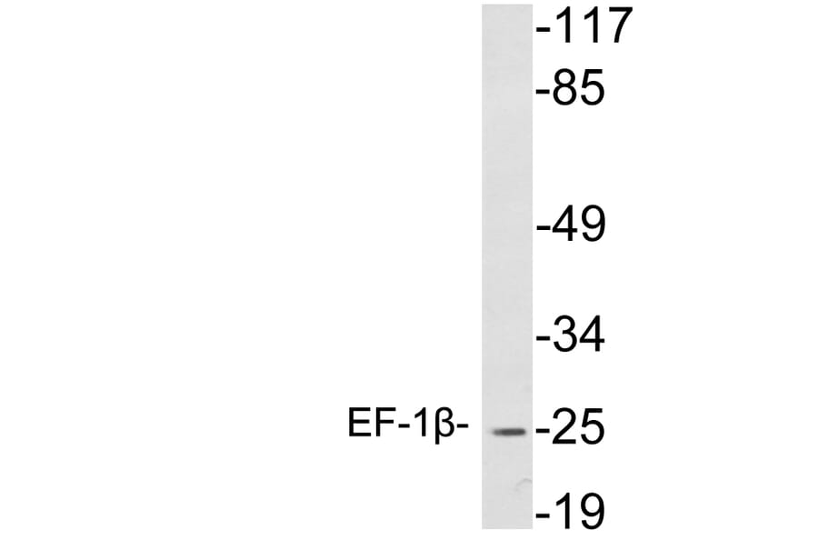 Western Blot - Anti-EF-1beta Antibody (R12-2125) - Antibodies.com