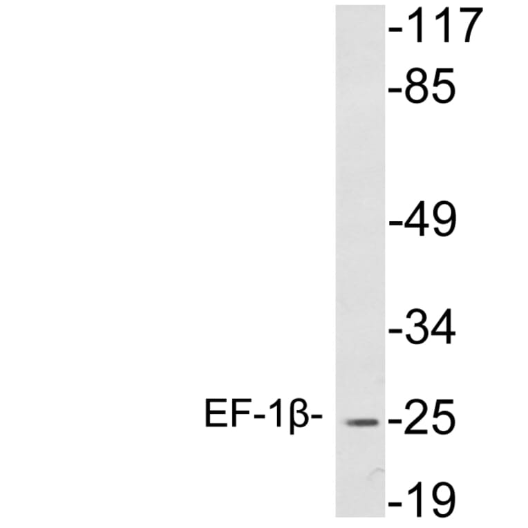 Western Blot - Anti-EF-1beta Antibody (R12-2125) - Antibodies.com