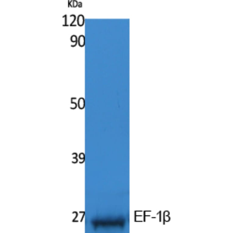 Western Blot - Anti-EF-1beta Antibody (R12-2125) - Antibodies.com
