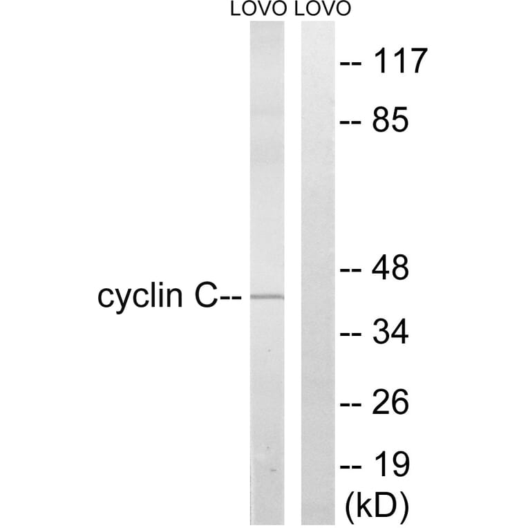 Western Blot - Anti-Cyclin C Antibody (B8334) - Antibodies.com