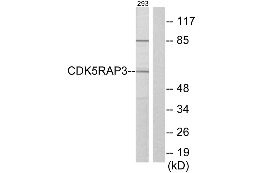Western Blot - Anti-CDK5RAP3 Antibody (C12192) - Antibodies.com