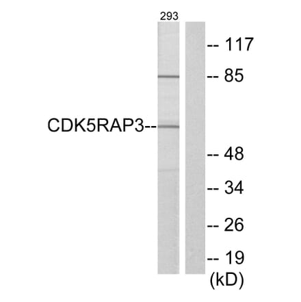 Western Blot - Anti-CDK5RAP3 Antibody (C12192) - Antibodies.com