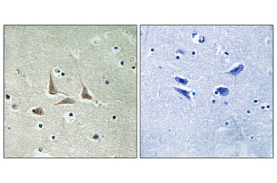 Immunohistochemistry - Anti-CDK5RAP3 Antibody (C12192) - Antibodies.com
