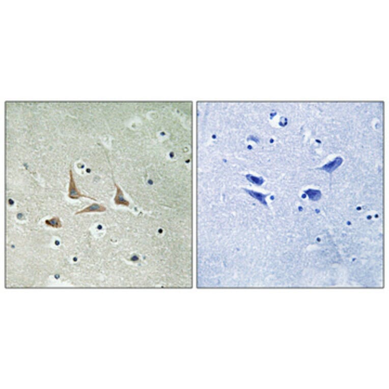 Immunohistochemistry - Anti-CDK5RAP3 Antibody (C12192) - Antibodies.com