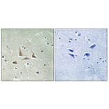 Immunohistochemistry - Anti-CDK5RAP3 Antibody (C12192) - Antibodies.com