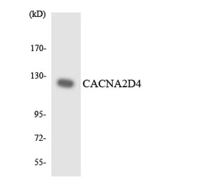 Western Blot - Anti-CACNA2D4 Antibody (R12-2561) - Antibodies.com