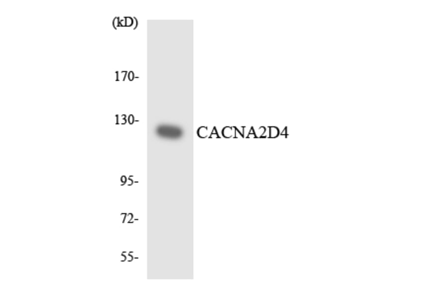 Western Blot - Anti-CACNA2D4 Antibody (R12-2561) - Antibodies.com