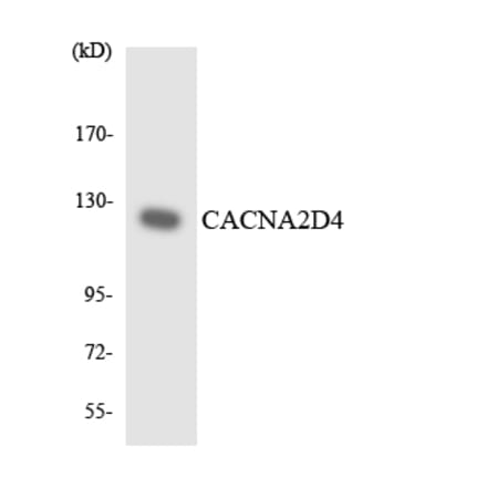 Western Blot - Anti-CACNA2D4 Antibody (R12-2561) - Antibodies.com