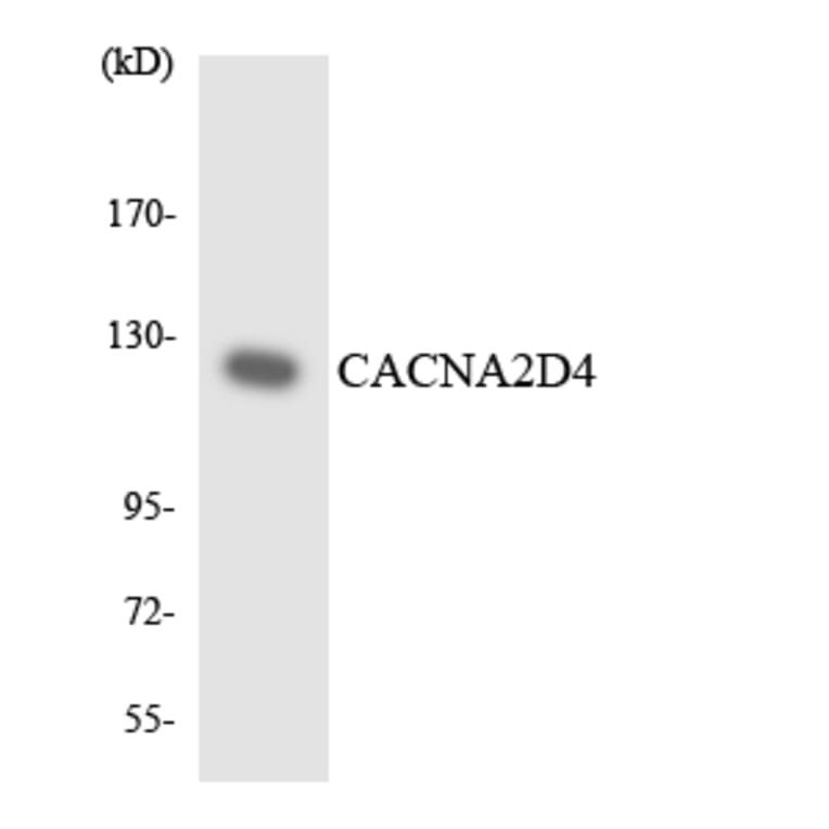 Western Blot - Anti-CACNA2D4 Antibody (R12-2561) - Antibodies.com