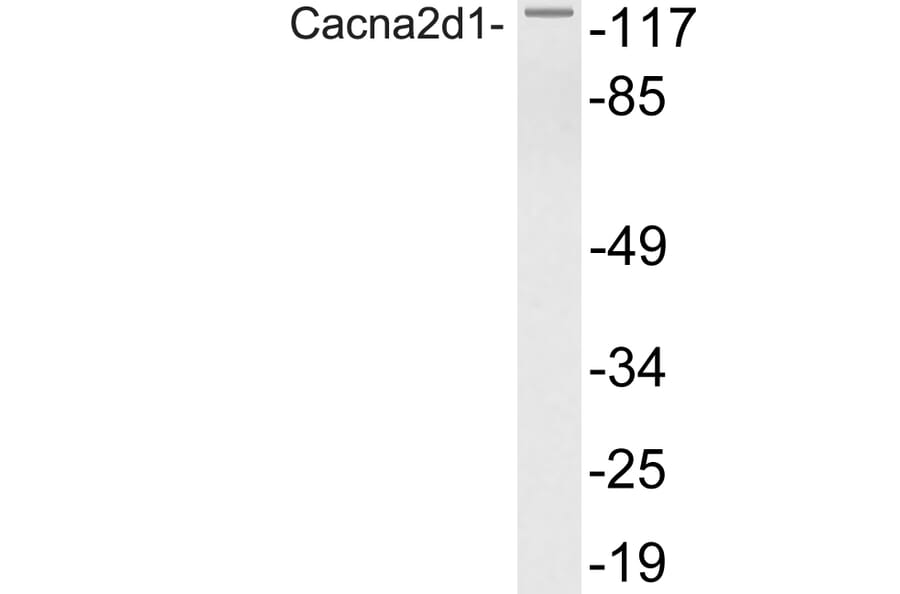 Western Blot - Anti-Cacna2d1 Antibody (R12-2048) - Antibodies.com
