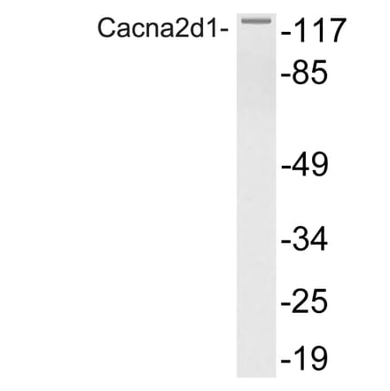 Western Blot - Anti-Cacna2d1 Antibody (R12-2048) - Antibodies.com