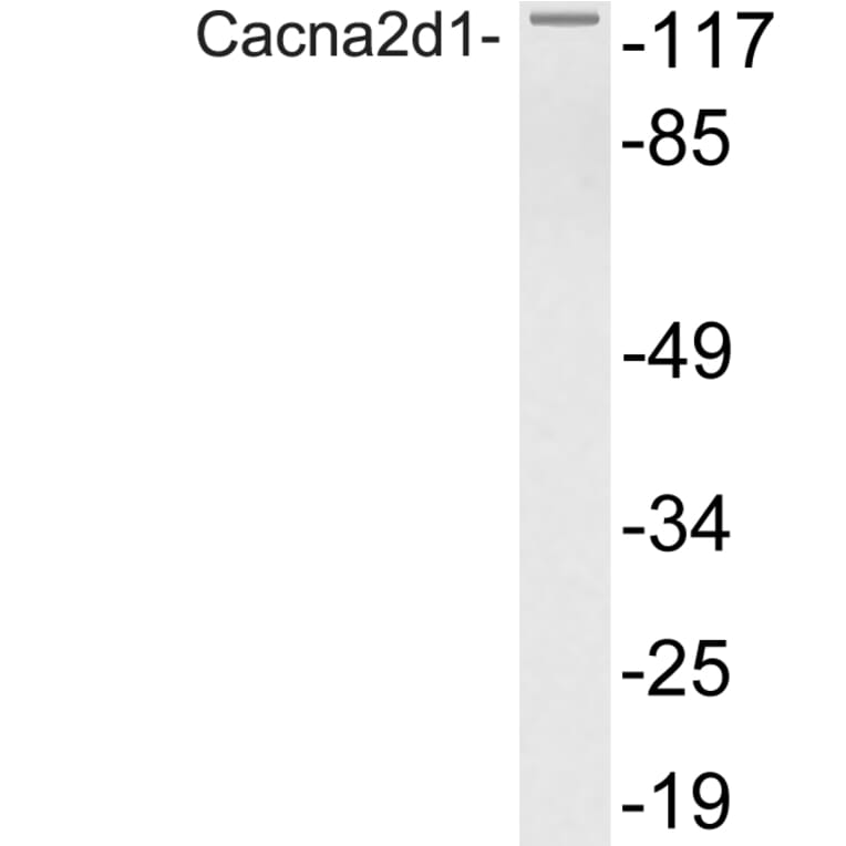 Western Blot - Anti-Cacna2d1 Antibody (R12-2048) - Antibodies.com