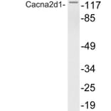 Western Blot - Anti-Cacna2d1 Antibody (R12-2048) - Antibodies.com