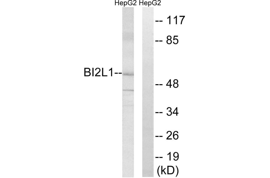 Western Blot - Anti-BAIAP2L1 Antibody (C14787) - Antibodies.com