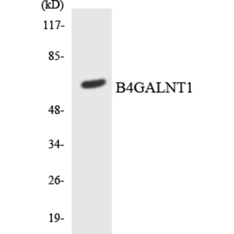 Western Blot - Anti-B4GALNT1 Antibody (R12-2531) - Antibodies.com