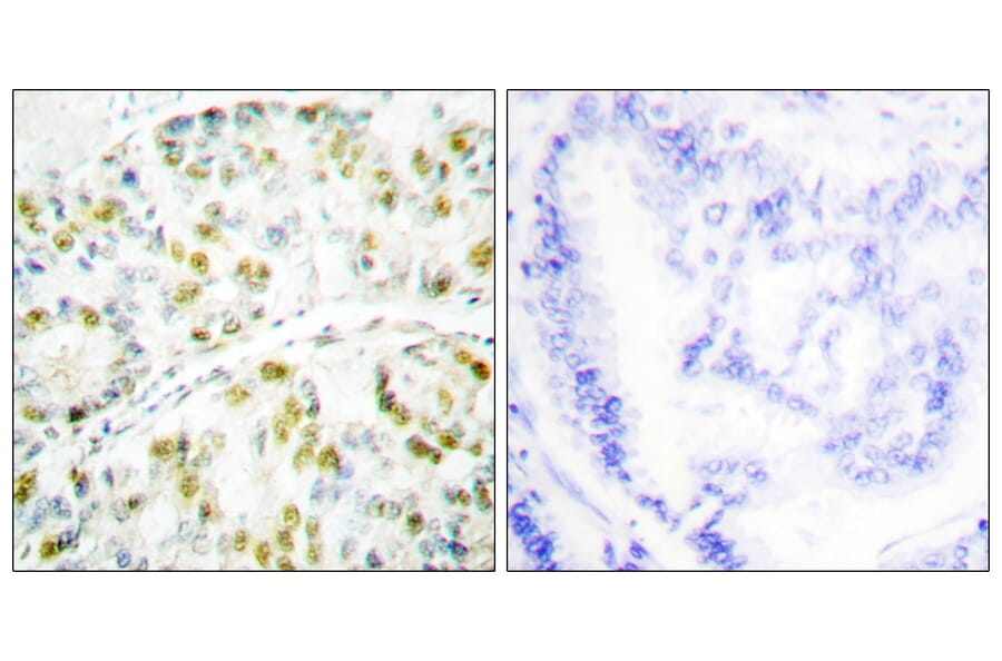 Immunohistochemistry - Anti-Ataxin 1 Antibody (B0771) - Antibodies.com