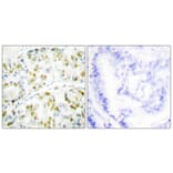 Immunohistochemistry - Anti-Ataxin 1 Antibody (B0771) - Antibodies.com