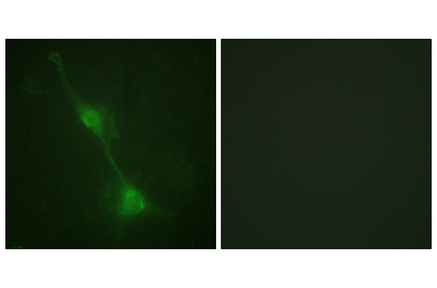 Immunofluorescence - Anti-Ataxin 1 Antibody (B0771) - Antibodies.com
