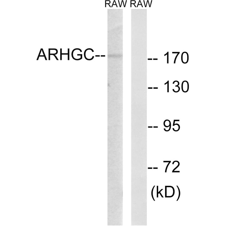 Western Blot - Anti-ARHGEF12 Antibody (C18388) - Antibodies.com