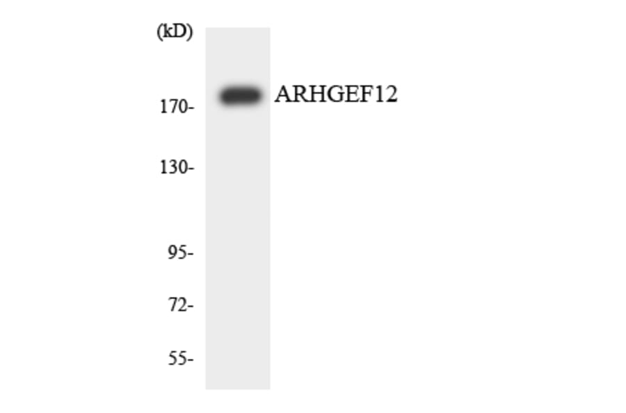 Western Blot - Anti-ARHGEF12 Antibody (R12-2504) - Antibodies.com