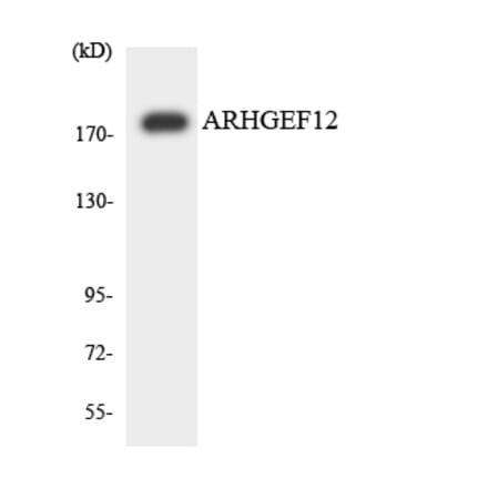 Western Blot - Anti-ARHGEF12 Antibody (R12-2504) - Antibodies.com