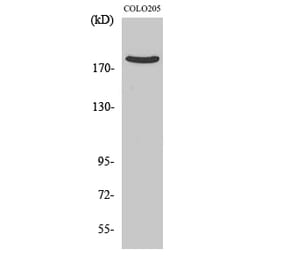 Western Blot - Anti-ARHGEF11 Antibody (C18387) - Antibodies.com