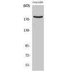 Western Blot - Anti-ARHGEF11 Antibody (C18387) - Antibodies.com