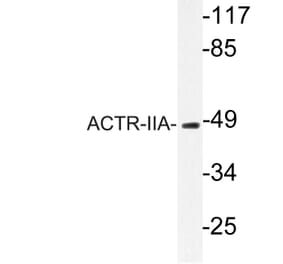 Western Blot - Anti-ACTR-IIA Antibody (R12-2012) - Antibodies.com